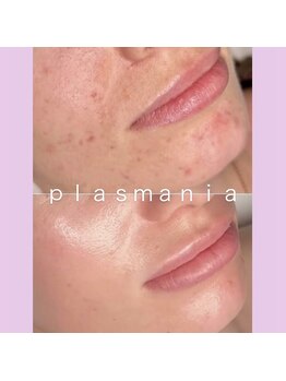 スーン(soon)/真皮層から輝くハリ・弾力の肌へ