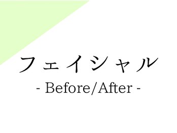 シードリン(Seedling)/