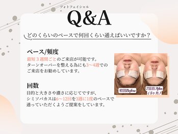 アイラブワン(eye love one)/気になるQ＆A　通うペースは？