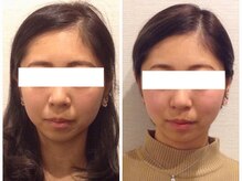 ウェリナ平和堂長久手院/小顔矯正/骨盤矯正/美脚サロン