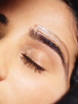 メディカルサンテロッソ 福岡店(MEDICAL SANTEROSSO)の写真/[フェイスワックス脱毛＋最新美肌マシン]古い角質・産毛までケアして速攻ツルツルに♪