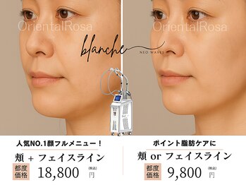 オリエンタルローザ 表参道(Oriental Rosa)/マイクロ波オンダプロ小顔リフト