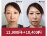 ぷるっと生コラーゲン導入＆小顔矯正×深層フェイスケア 13,900円→10,400円