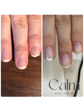カーム(Calm)/続けることで美爪へ