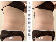 リアレント 高槻店(Lialent)の雰囲気(もう、無理な食事制限はしなくて大丈夫です)