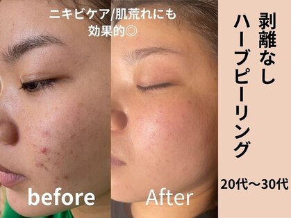 プルメリアの写真