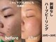 プルメリアの写真