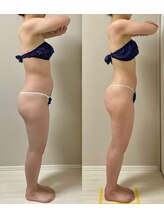 ウム 四ツ橋店(umu)/セルゼロの仕上がり