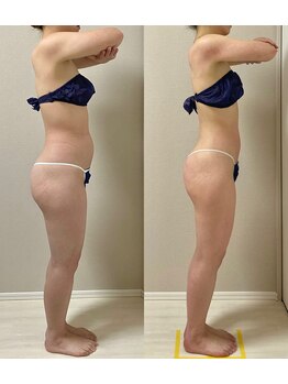 ウム 四ツ橋店(umu)/セルゼロの仕上がり