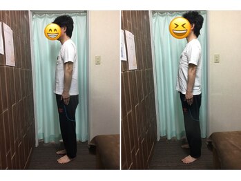 マリモ鍼灸接骨院/姿勢改善！！