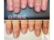 アンドネイル 海老名(&nail)/爪周りの甘皮も綺麗に！