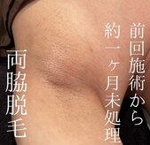 モア男子(MORE男子)