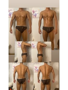 京橋メンズビューティーラボ(KMB LAB.)/ハイパーナイフのbefore/after