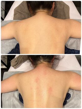 フィックスユー ビューティー(Fixyou BEAUTY)/ブライダルコース　before after