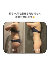 ブリエ(BRiLLER)/#ラジオ波コアヒートエステ