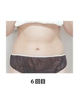 ヨサパーク テマ 牛込柳町店(YOSA PARK tema)/痩身/よもぎ蒸し/小顔/リンパ