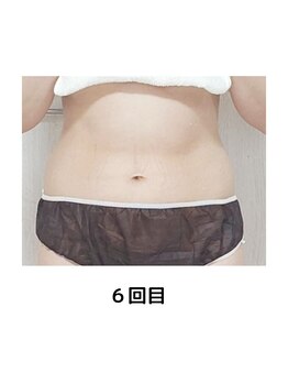 ヨサパーク テマ 牛込柳町店(YOSA PARK tema)/痩身/よもぎ蒸し/小顔/リンパ