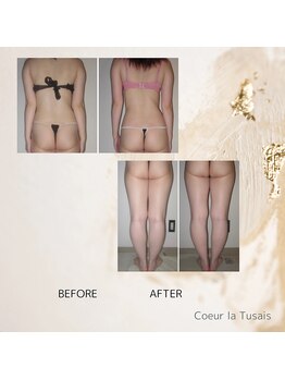 クーラ テュセ(Coeur la Tusais)/【40歳まで】全身まるごと痩身