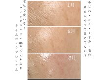 アスピリア(aspirer a')の雰囲気(肌質改善でもう隠さない肌へ‥素顔に自信を‥)