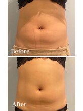 ルナグランデ(Luna grande.)/下腹ポッコリも解消できます