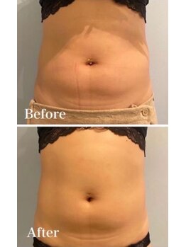 ルナグランデ(Luna grande.)/下腹ポッコリも解消できます