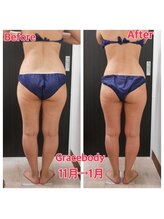 グレイスボディ BiViつくば店(Grace Body)/ボディ症例写真