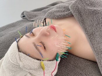鍼グリッター 岡山本院(鍼Glitter.)の写真/『美容鍼をもっと身近に』低価格で通いやすい美容鍼《初回限定価格3900円～》今以上の美肌習慣を当店で♪