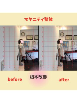 心斎橋長堀フェムテック整骨院/妊活 マタニティ 整体 妊活