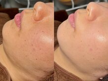 ルーナジェーナ(Luna llena)/池袋　エステ　ルーナジェーナ