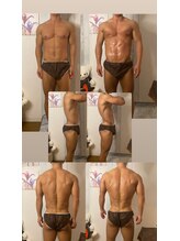 京橋メンズビューティーラボ(KMB LAB.)/ハイパーナイフのbefore/after