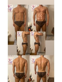 京橋メンズビューティーラボ(KMB LAB.)/ハイパーナイフのbefore/after