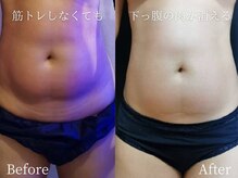 ミスティア(mistia)/エステ お腹３回