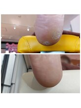 爪切り屋 足楽/