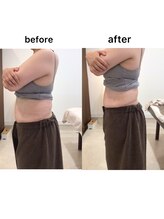 ジョワイユ(Joyeux)/腸の位置でお腹は変わる