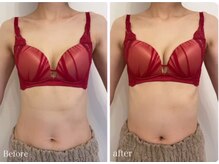 スマイルクルー(SmileClue)/ビフォーアフター症例