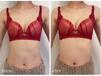 スマイルクルー(SmileClue)/ビフォーアフター症例