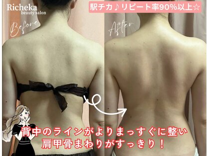 リシェカ(Richeka)の写真