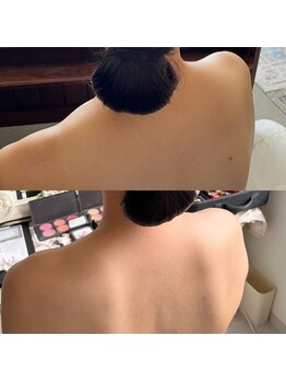 リュウ(le.lieu)の写真/花嫁は猫背厳禁！！ドレス映えする背中とデコルテに☆直前対応も可能ですが、半年前にぜひご相談ください◎