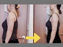 ポノフィット(PONO FIT.)/症例／全身シルエット