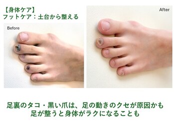 サロンラグナ(Salon Laguna)の写真/整体に行っても戻る肩こり・腰痛・膝痛、足のクセが原因かも？身体の土台から整えるフットケア