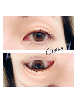 シスタス(Cistus)/ラッシュリフト