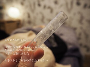 ウルケ(URUKE)/毛穴徹底洗浄