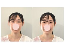 スタイルキューピット(style cupit)/メイクビフォアフター＊30代