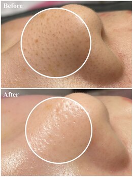 ミラ(MILA)/フェイシャル【1】