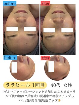 ユフラ(Juhla)/ララピール