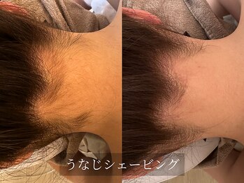 アルム(Arum)/うなじシェービング