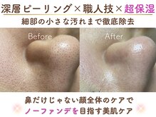 ミサズ スキンケア(misa's skin care)