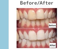 キングスサロン 神戸ハーバーランド店/Before / After