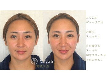 エナジーメソッド雅(miyabi)/睡眠不足でデトックス力が
