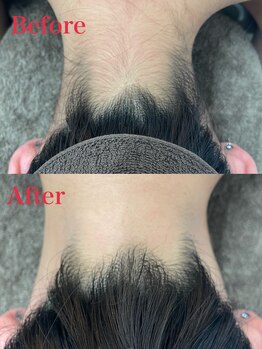 ミース 越谷店/うなじ矯正●Before、After